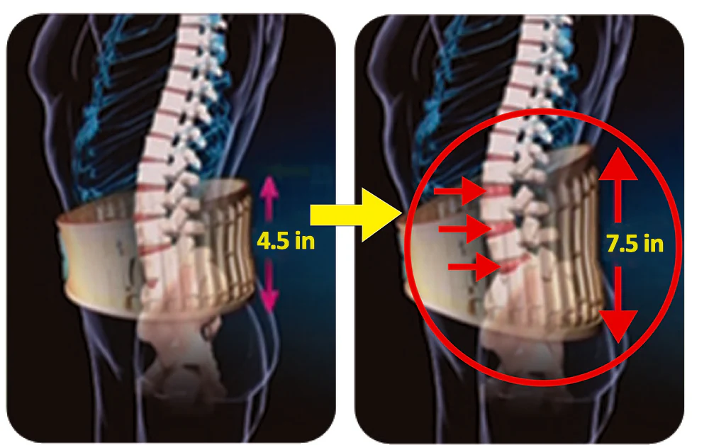 Dr Ho's 2-in-1 Decompression Back Belt - Image 2