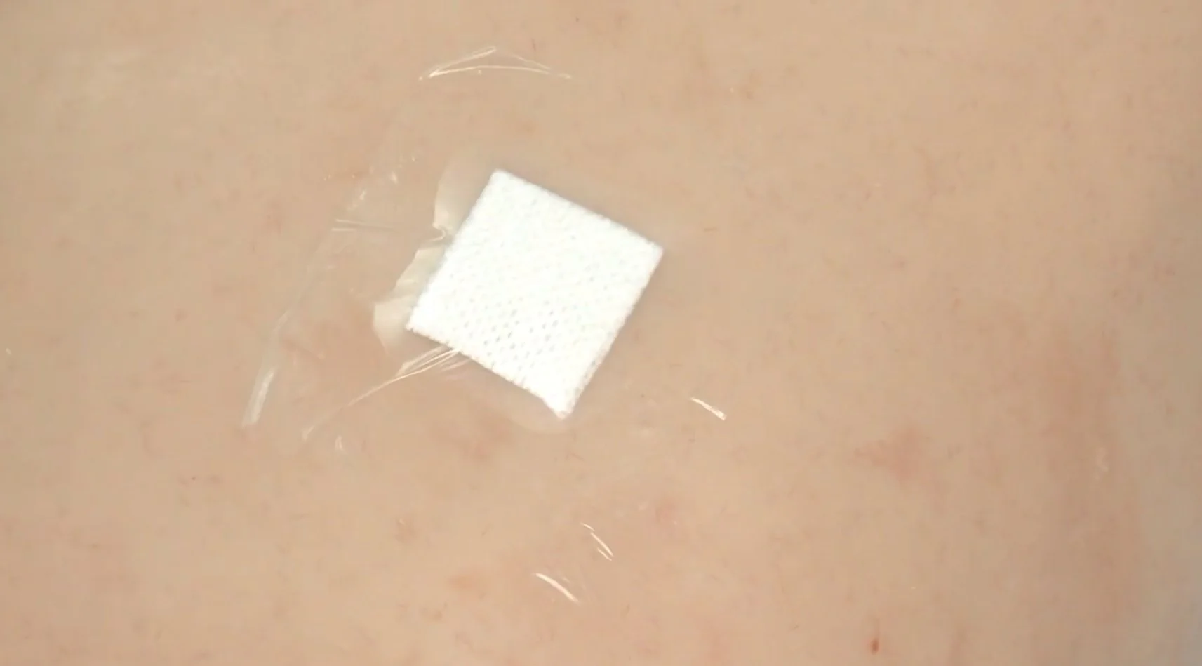 Mölnlycke Mepore Film Dressing
