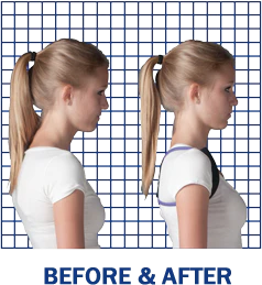 Vitality Depot Posture Medic - Image 8