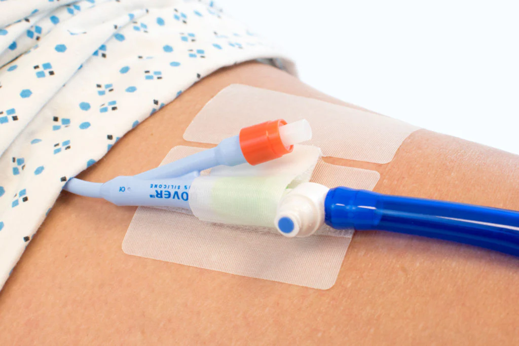 Secure Lock Catheter