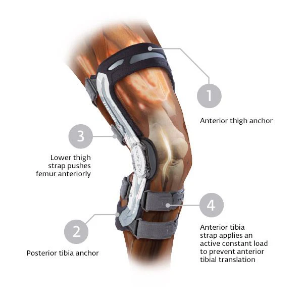 DonJoy A22 Custom Knee Brace - Image 3